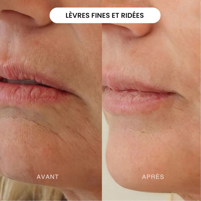 Crème Facelift+ Booster Collagène