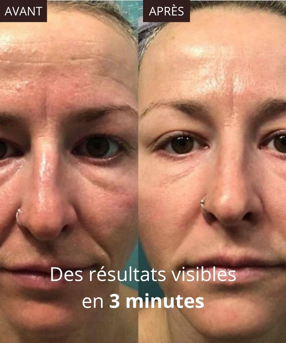 Crème lifting visage instantané