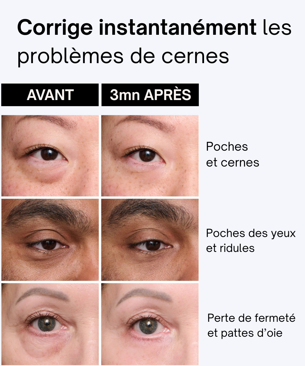 Crème Instant Facelift+