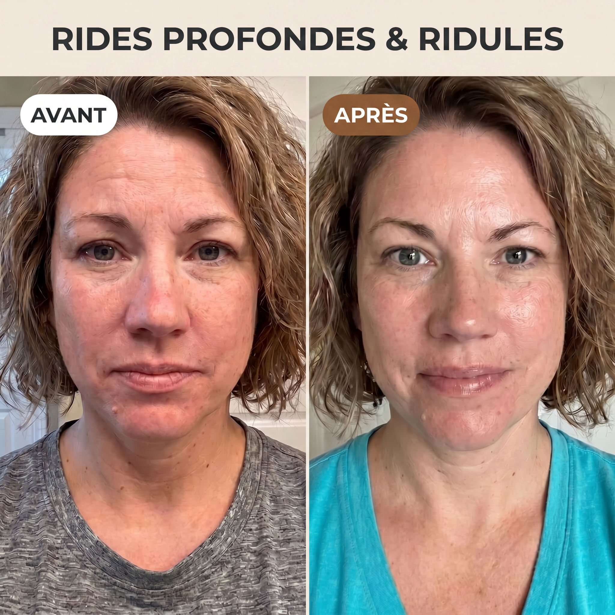 Crème miracle lifting