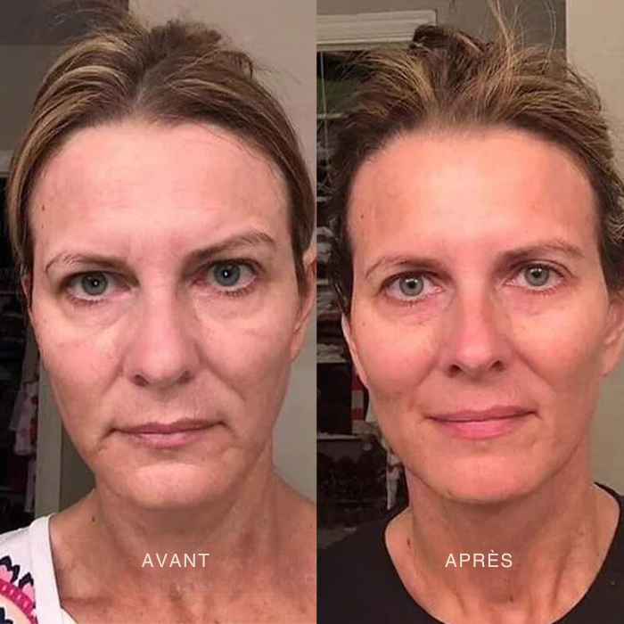 Crème Facelift+ Booster Collagène