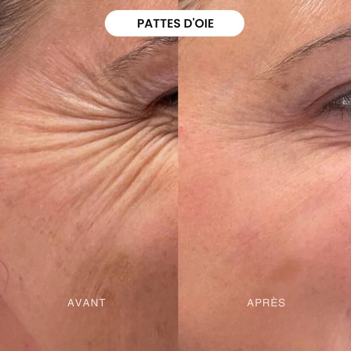 Crème Facelift+ Booster Collagène