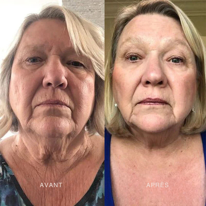 Crème Facelift+ Booster Collagène
