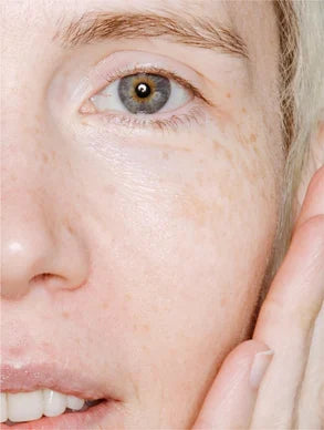 Brume visage prébiotique pour le microbiome